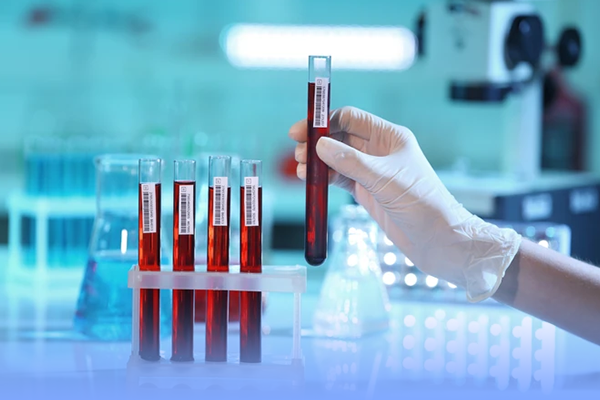 Pemeriksaan Preparat lmu